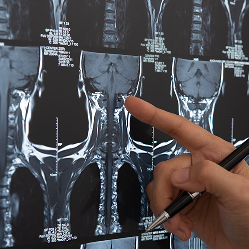 image of head and neck x-ray