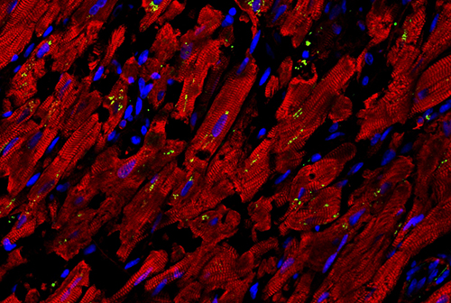 Confocal image of heart autopsy sample of a COVID-19 patient