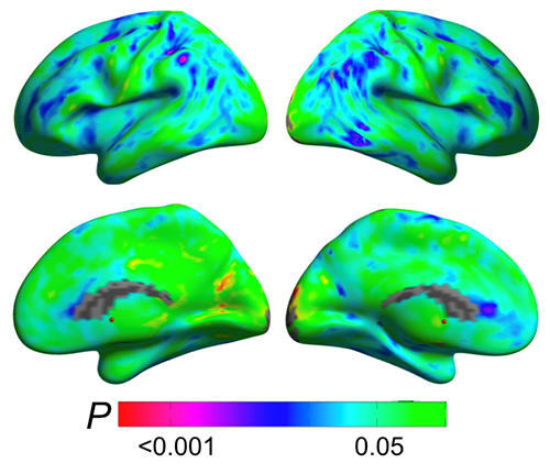 After Menopause brain scans