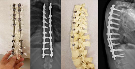 images of hardware and xray scans