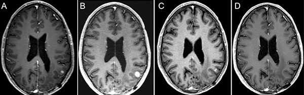 brain scans