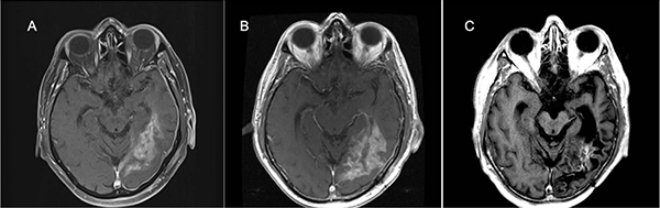 brain scans