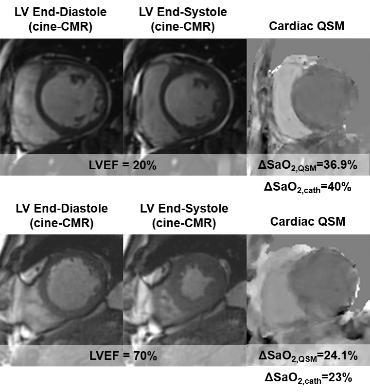 Scans of ventrical function