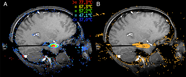 visual of human brain