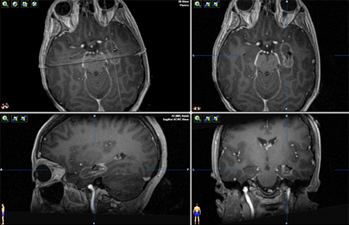 visual of human brain