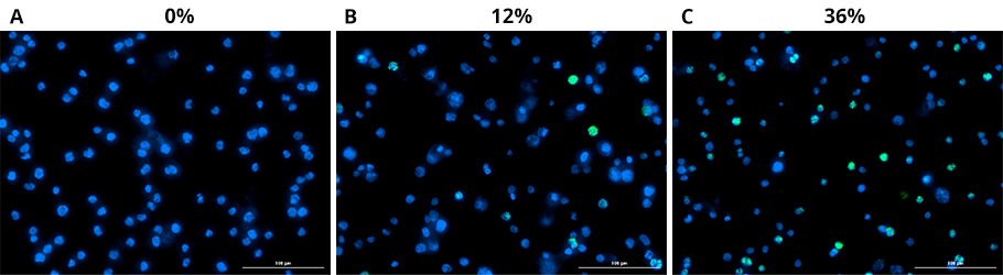 images of Immunofluorescence staining of cells with and without drug treatment