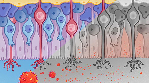 COVID-19 infects sustentacular cells of the olfactory epithelium