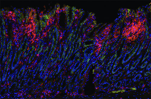 cancer cells from a mouse model