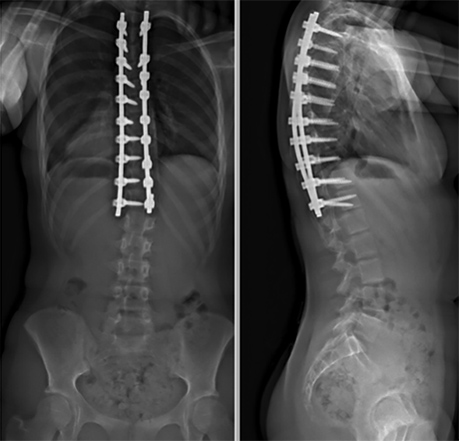 Postoperative radiology images for fusion