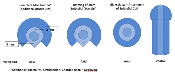 other viewpoint of Tear Drop Urethral Mobilization and Advancement Repair