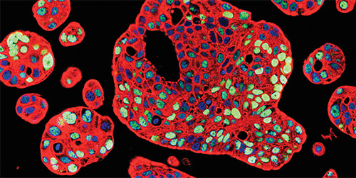 patient-derived human bladder tumor organoids