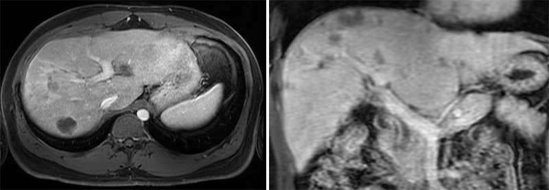 image of mri scans