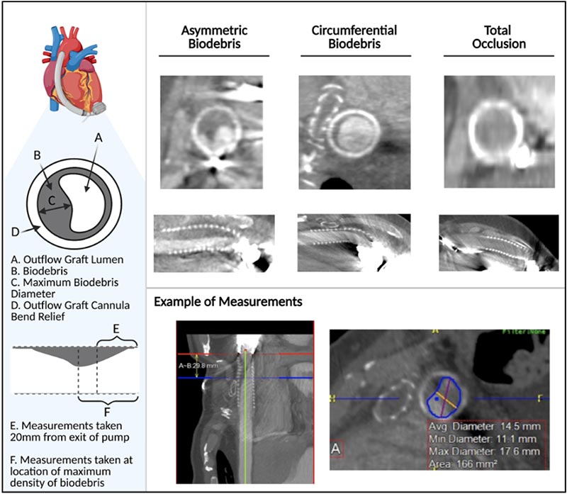 Approach to Imaging Analysis