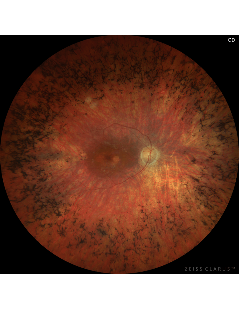 Human eye scan