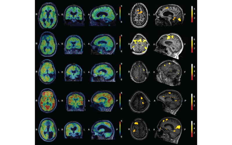 Brain imaging series