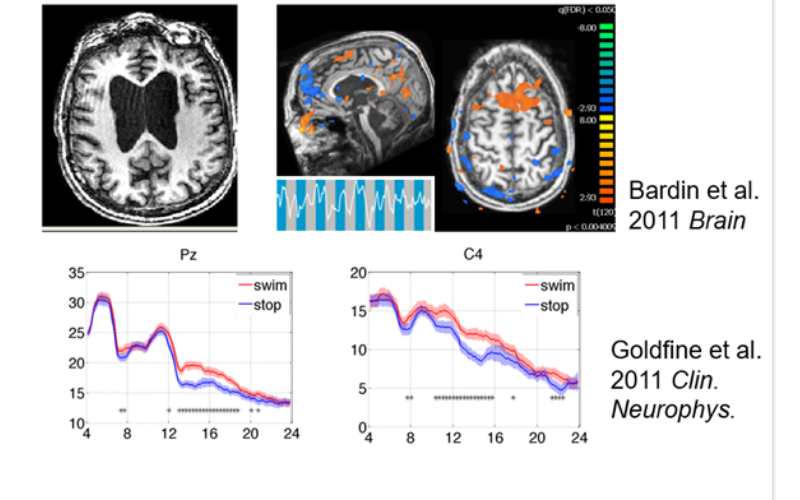 fMRI and EEG based analyses