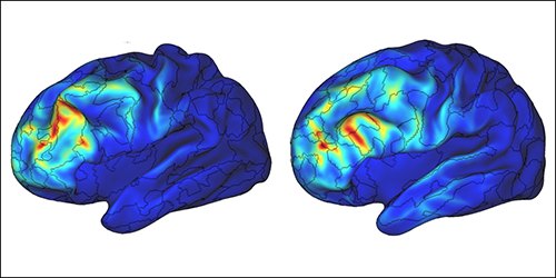 Image showing activity in the brain during depression